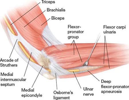 Elbow injury treatment at Sports Pain Institute NYC — Dr. Febin Melepura