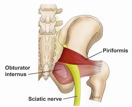 Piriformis syndrome treatment doctor hip specialist NYC — Dr. Febin Melepura