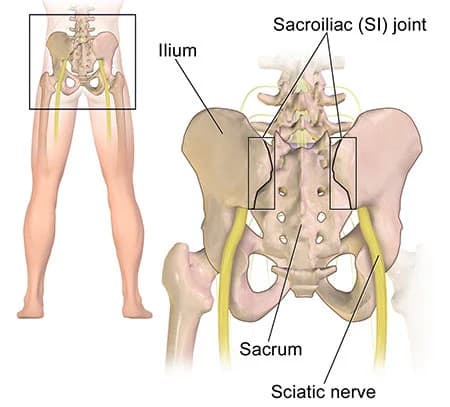 Sacroiliac joint dysfunction treatment doctor specialist NYC — Dr. Febin Melepura