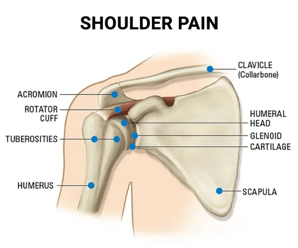 Shoulder pain treatment doctor specialist NYC — Dr. Febin Melepura