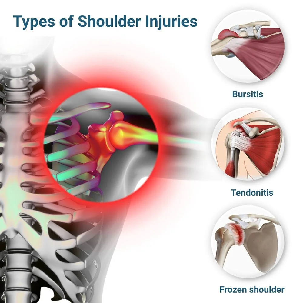 Types of Shoulder Injuries — diagram